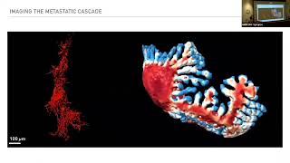 Kevin Dean quotImaging the Metastatic Cascade with Axially Swept LightSheet Microscopyquot [upl. by Suhsoj939]