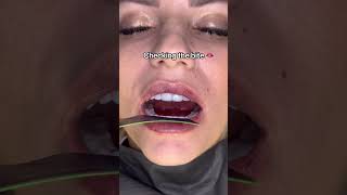 Check bite points teeth and film soundsdentist health teethcleaning 🦷beadrepair [upl. by Aulea]