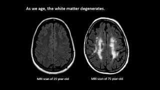 The Aging Brain  Week by Week Time Lapse [upl. by Appel]