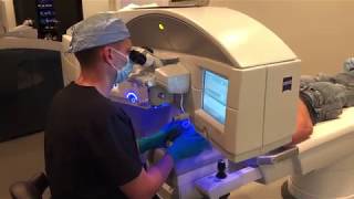 Lance Kugler MD Shares His LASIK Testimonial [upl. by Ruffin]