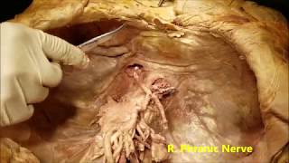 DIAPHRAGM PART 1 WITH CLINICAL ASPECTS  SANJOY SANYAL [upl. by Sinnaoi]