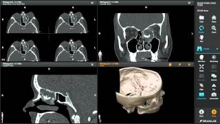 DICOM Viewer—Medical Image Manipulation [upl. by Lang]