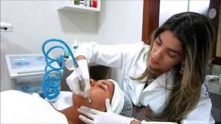 Peeling para tratamento de Acne manchas e rejuvenescimento  JULIANA MARTINS [upl. by Rhonda]