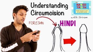 Overview of Circumcision Hindi [upl. by Ativla]