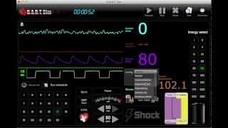 ECG Simulator  EKG Rhythm Simulator [upl. by Tessi]