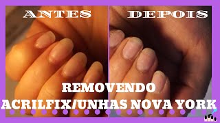 COMO REMOVER ALONGAMENTO ACRILFIX UNHAS NOVA YORK [upl. by Hermine]