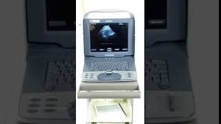 Presenting Siemens Acuson Cypress Ultrasound Machine with Vascular Probe  Drs Toy Store [upl. by Annelg566]