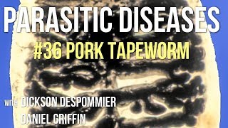 Parasitic Diseases Lectures 36 Pork Tapeworm [upl. by Lucia340]