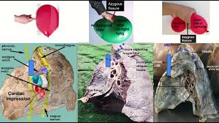 Azygos Vein amp Fissure on Radiology Xray CT amp MRI [upl. by Nylirac267]