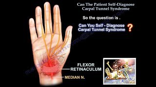 Patient Self Diagnose Carpal Tunnel Syndrome  Everything You Need To Know  Dr Nabil Ebraheim [upl. by Jensen]