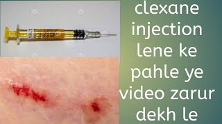 clexane injection in pregnancy [upl. by Napra248]