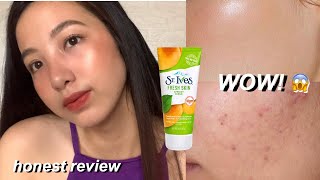 STIVES APRICOT SCRUB HONEST REVIEW  ANTI BLACKHEADS SCRUB [upl. by Boffa418]