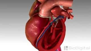 Insuficiência Cardíaca Congestiva  Animação em 3D [upl. by Suivatram]