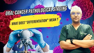 Dr Rudra Mohan Histopathological Staging  Differentiation Of Oral Cancer  Simplified at a glance [upl. by Giulietta]