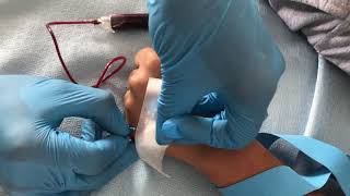 Venipuncture Butterfly Method [upl. by Acinaj82]