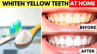 3 Easy DIY Teeth Whitening Hacks [upl. by Tnilf920]