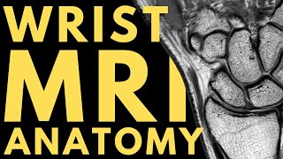 Wrist MRI Anatomy  Radiology anatomy part 1 prep  How to interpret a wrist MRI [upl. by Morril]