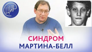 Синдром МартинаБелл Ген FMR1 Анализ интерпретация клинические проявления синдрома МартинаБелл [upl. by Llecrup379]