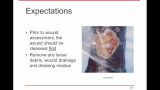 WoundRounds Webinar  Wound Assessment amp Documentation A Practical Guide [upl. by Rovert]