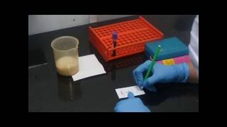 Malaria Detection Demo by Using InstaDNA™ Card  HiMedia Laboratories [upl. by Doone675]