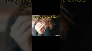 These things do NOT cause balding bald balding baldingsolution haircare hair hairstyle shorts [upl. by Emilia]