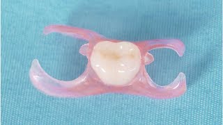 What You Need to Know About a Flipper Tooth Temporary Partial Denture  Tita TV [upl. by Stanly75]