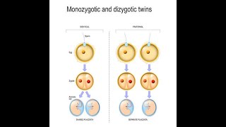 Introduction to Twinning Embryology Monozygotic Uniovular Dizygotic Biovular twins [upl. by Shandie919]