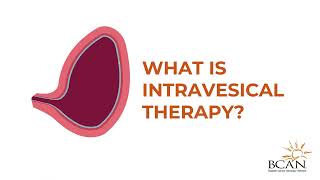 What is Intravesical Therapy  Bladder Cancer Advocacy Network [upl. by Lisha]