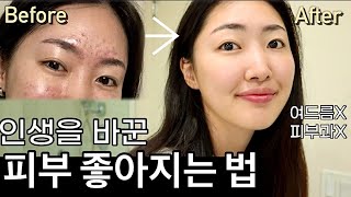 Eng cc 피부과에선 안알려준 돈 안들이고 피부 좋아지는 법✨ 좀 더 일찍 알았더라면🤦🏻‍♀️ [upl. by Aikyt460]