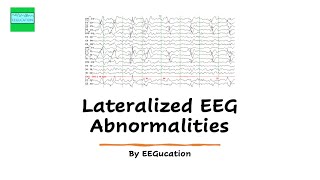 Lateralized EEG Abnormalities [upl. by Wendelin]