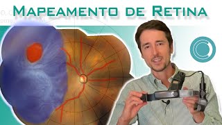 Exame de Mapeamento de Retina [upl. by Sivrahc]