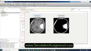 Tumor extraction matlab [upl. by Daron]