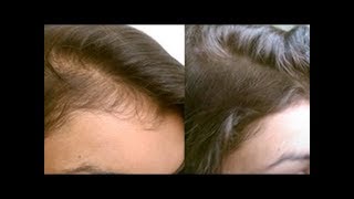 Hair Growth Tips in Tamil  Hair growth home remedies  Hair Tips in Tamil Beauty Tv [upl. by Lempres]