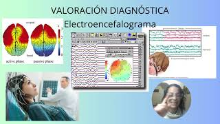 TC Resonancia magnética Electroencefalograma y punción lumbar  Función Neurológica 5 [upl. by Mufi996]