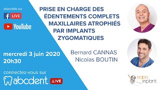 Bernard CANNAS Nicolas BOUTIN  Les implants zygomatiques [upl. by Nahc]