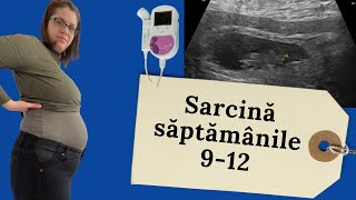 Jurnal de sarcina 912 saptamani  termin trimestrul 1  tratamente ecografii si fetal Doppler [upl. by Bolen]