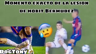 Lesión de quotHobbitquot Bermúdez hoy en el partido Atlante vs Dorados momento exacto [upl. by Adrial]