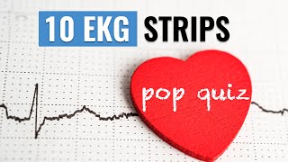 10 EKG Strips POP QUIZ for the NGN NCLEX RN  NAME that Heart Rhythm [upl. by Shaff]