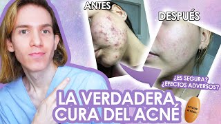 ROACCUTAN o ACCUTANE Efectos adversos como tomarla antes y despues LA VERDAD de la ISOTRETINOINA [upl. by Lord]