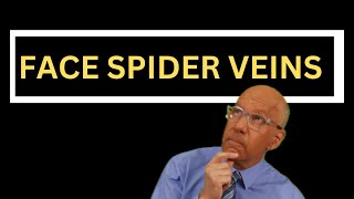 How to Treat Spider Veins on the Face 5 Essential Facts for Doctors and Nurses [upl. by Nileve]