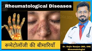 रूमेटोलॉजी की बीमारिया  Common Rheumatological Diseases [upl. by Bernardine]