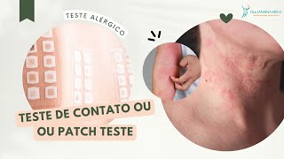 Teste de Contato ou PATCH TESTE [upl. by Barina730]