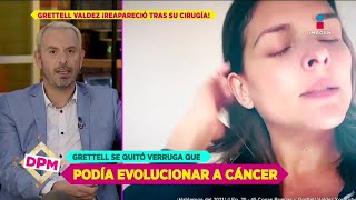 Primeras declaraciones de Grettell Valdez tras operación en uno de sus dedos  De Primera Mano [upl. by Anaujal545]