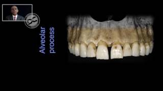 Ridge alterations after tooth extraction [upl. by Lednem335]