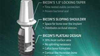 Introduction to Bicon SHORT® Implants [upl. by Ticknor905]