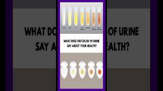 what does the color of your urine mean viral facts shorts [upl. by Duomham629]