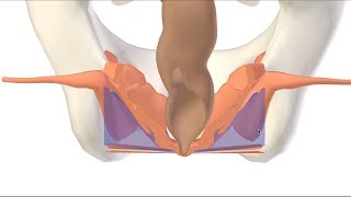 3D Ischioanal Ischiorectal Fossa [upl. by Ahsilav]