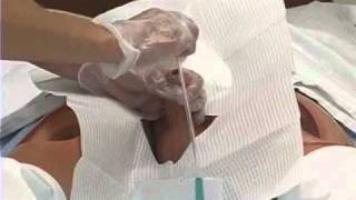 Foley Catheter Skills Demonstration 2 of 3 [upl. by Judah]