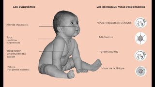 Dossier clinique corrigé en Pédiatrie  Bronchite aiguë ENCi [upl. by Shreeves512]