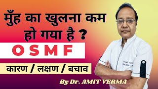 OSMF ORAL FIBROSIS हिंदी में  causes symptoms and treatment full explanation by dr amit verma [upl. by Dine]